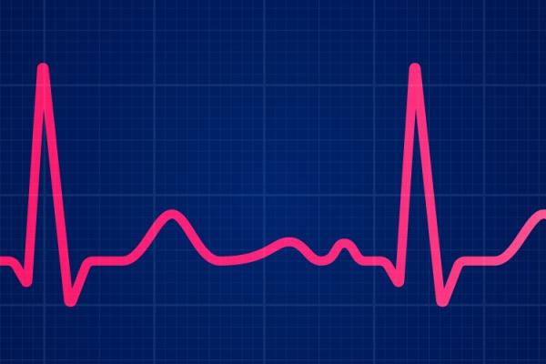 heart monitor line 